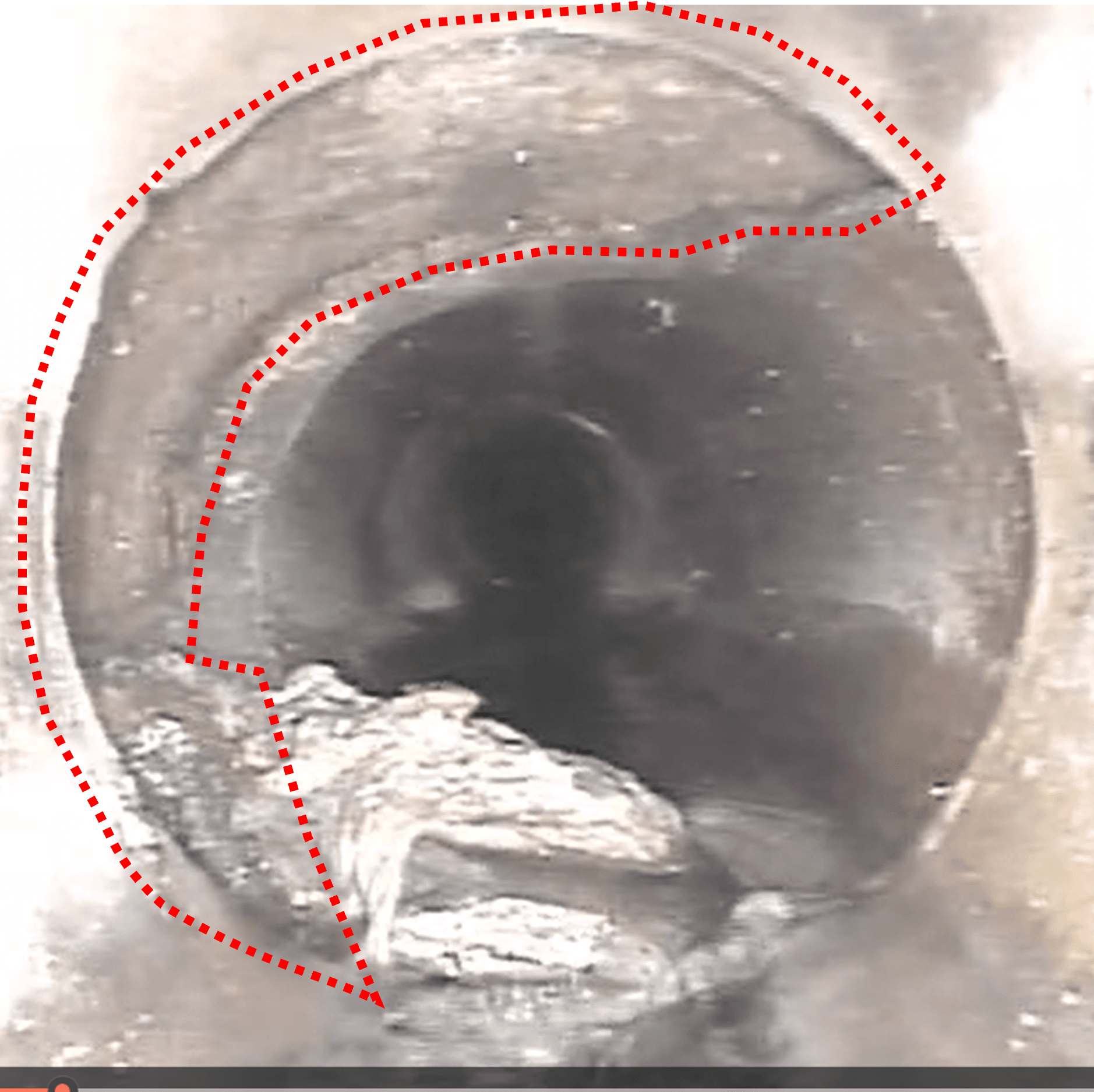 IMAGE OF DAMAGED SANITARY SEWER LINE